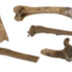 Bones